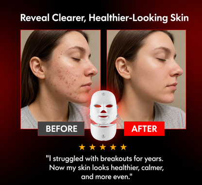 Dovira Pro LED Face & Neck Mask